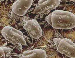 廣州除螨蟲(chóng)